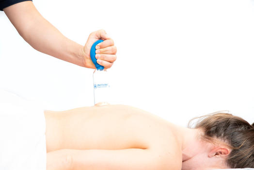 Cupping; wat is het en wat doet het?