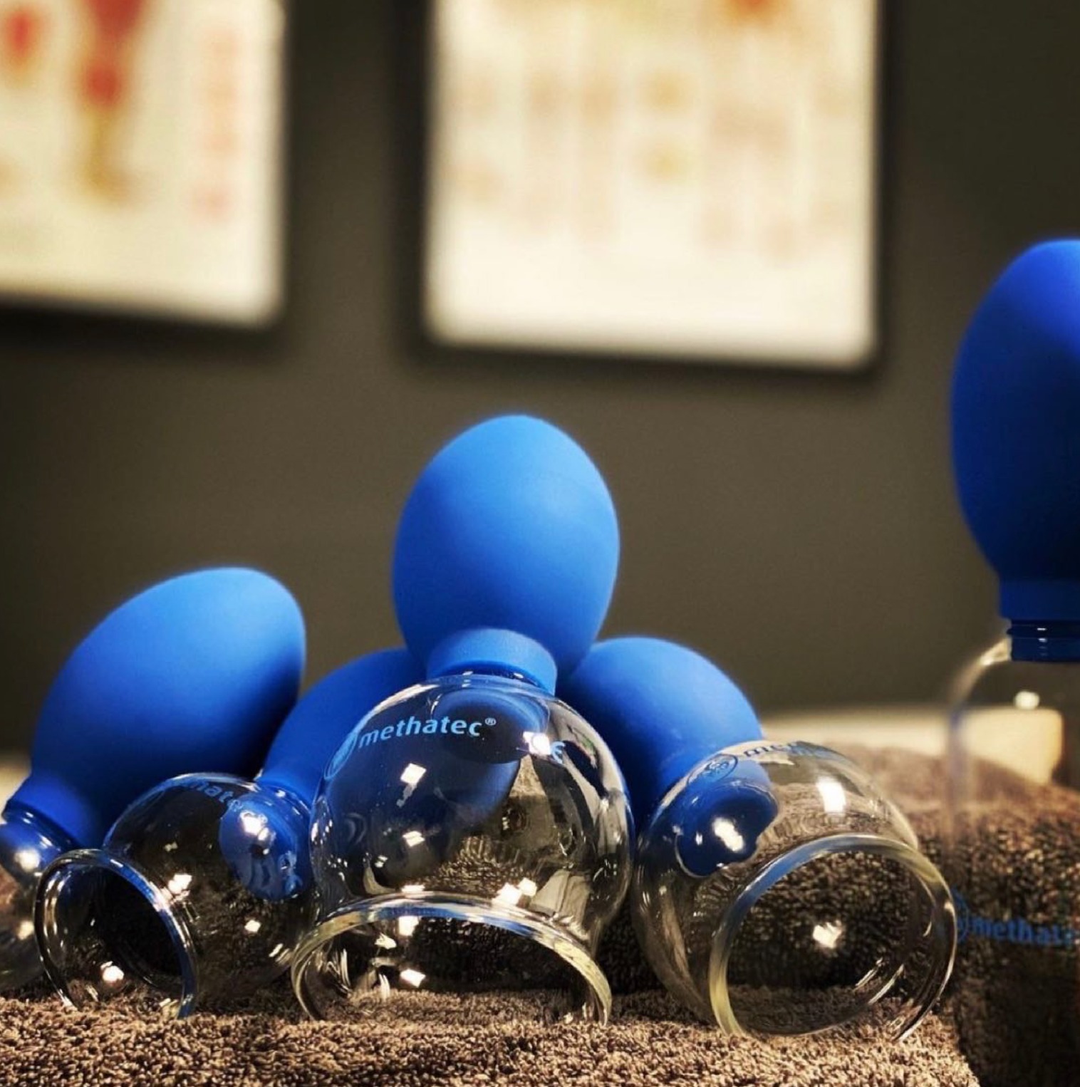 De kracht van vacuüm: cupping in de moderne praktijk